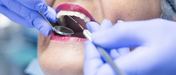 Best Emergency Treatment for Dental Infections or Abscesses in Melbourne Beach, FL